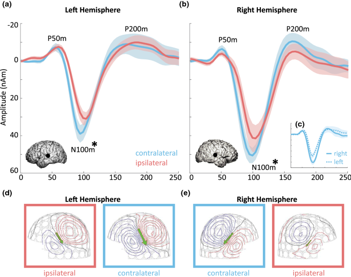 Automated cortical auditory evoked potentials threshold estimation in  neonates