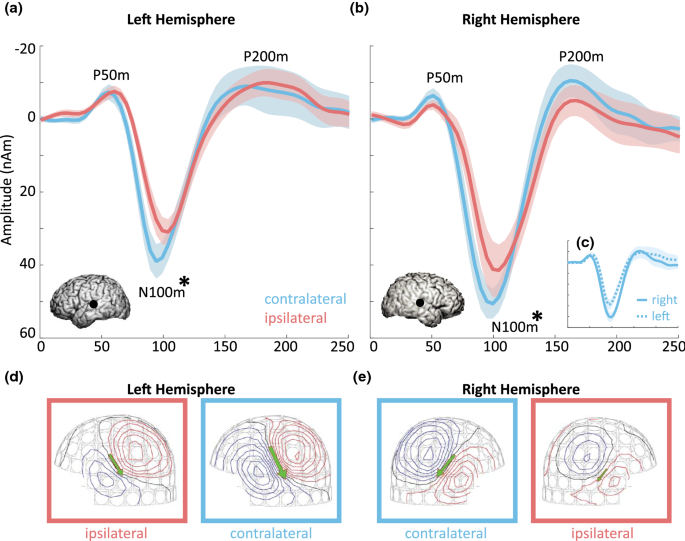 Automated cortical auditory evoked potentials threshold estimation in  neonates☆