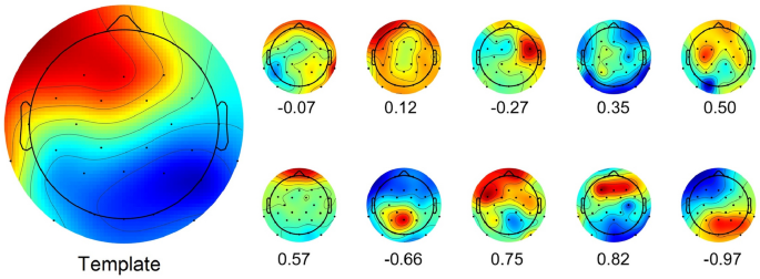 Electrical scalp map topographies (for each group, at the MMN