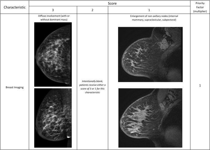Inflammatory breast cancer defined: proposed common diagnostic criteria to  guide treatment and research