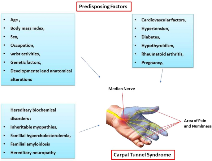 Pathophysiology, Diagnosis, Treatment, and Genetics of Carpal Tunnel  Syndrome: A Review
