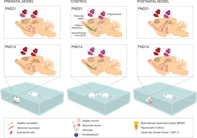 Stage-Dependent Disruptions in Neurogenesis and Neurotrophins' Production Following Prenatal and Postnatal Valproic Acid Exposure: Implications for Autism Spectrum Disorders | Cellular and Molecular Neurobiology