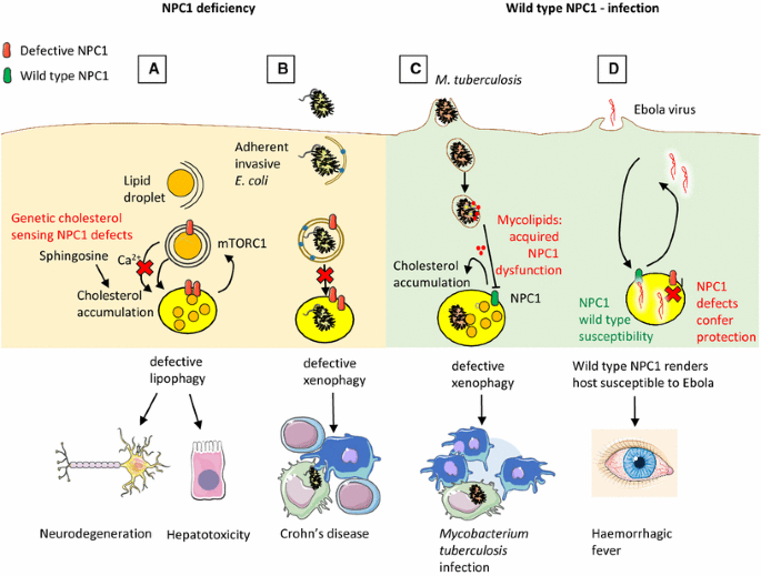 Niemann-Pick Type C Disease - NP-C Genetic Disease - Lysosomal Disease 