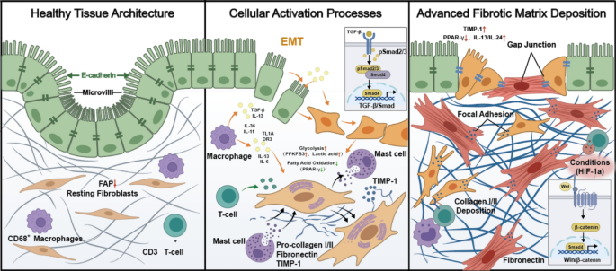 Intestinal Fibrosis in IBD: Rethinking the Inflammatory Paradigm and Emerging Therapeutic Opportunities.