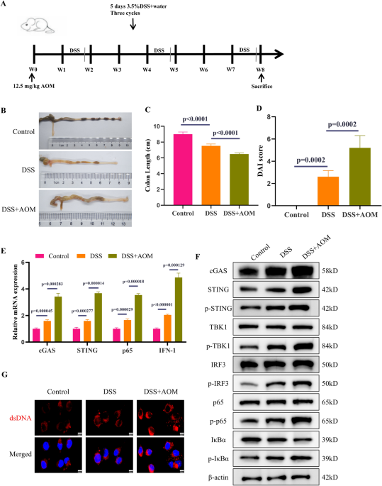 cGAS-STING Modulates the NF-κB Pathway to Influence the Occurrence of Ulcerative Colitis-Associated Colorectal Cancer