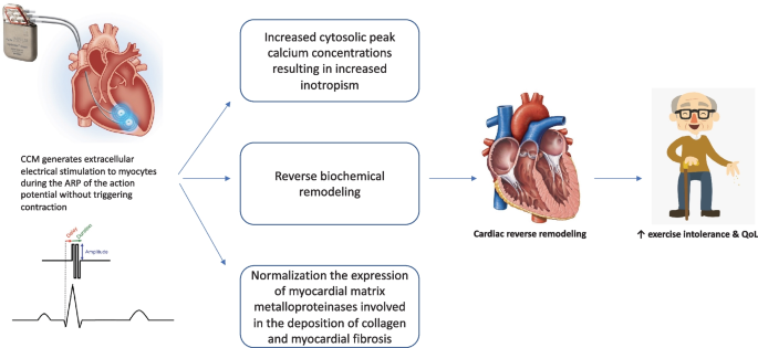 A Simpler and Shorter Neuromuscular Electrical Stimulation Protocol  Improves Functional Status and Modulates Inflammatory Profile in Patients  with End-Stage Congestive Heart Failure - International Journal of  Cardiovascular Sciences
