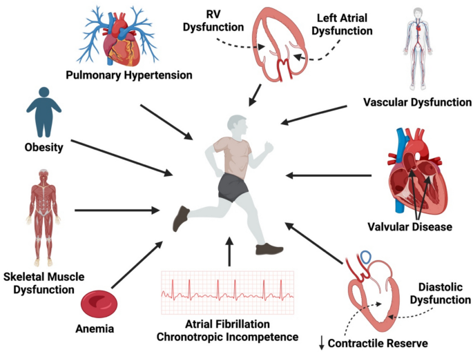 semaglutide exercise intolerance Mechanisms of exercise intolerance in heart failure with preserved ejection  fraction (HFpEF) | Heart Failure Reviews