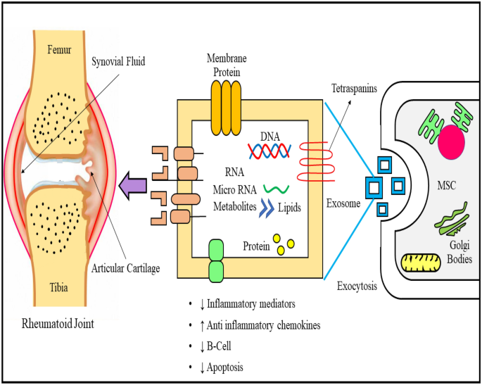 Exploring the role of exosomes in rheumatoid arthritis | Inflammopharmacology | Springer Nature Link