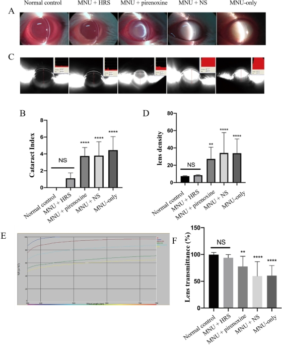 glutathione deficiency spinal spasticity Glutathione in Brain Disorders and Aging