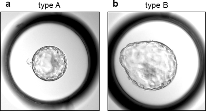 Hatching of mouse embryos in which one quarter (A) or half of the zona