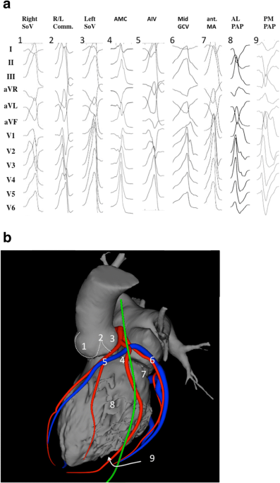 Interventional pathway in the management of refractory chronic flank pain:  Prospective series in 45 patients - Niraj - 2023 - Pain Practice - Wiley  Online Library