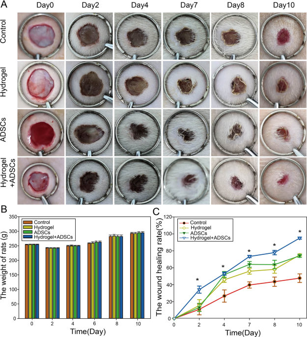 Antibacterial and antioxidant double-layered nanofibrous mat promotes wound  healing in diabetic rats