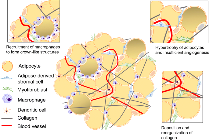 Weighing the Risk: effects of Obesity on the Mammary Gland and