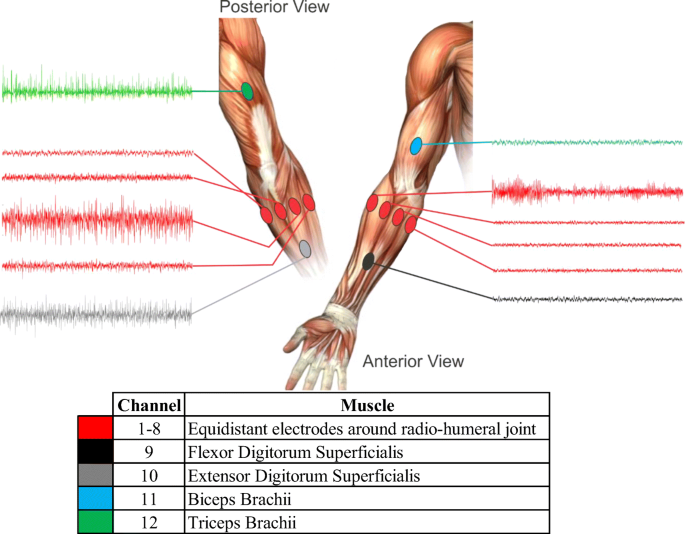 Electromyographic evaluation of upper limb muscles involved in armwrestling  sport simulation during dynamic and static conditions - ScienceDirect