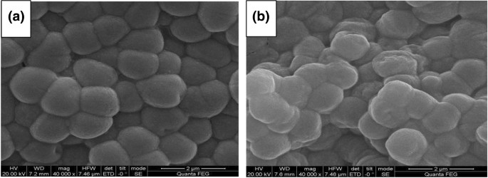 Deinococcus Radiodurans: The World's Toughest Bacterium. A Review