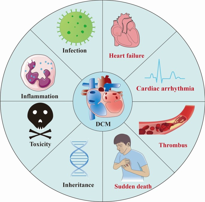 Dilated cardiomyopathy: from genes and molecules to potential treatments |  Molecular and Cellular Biochemistry