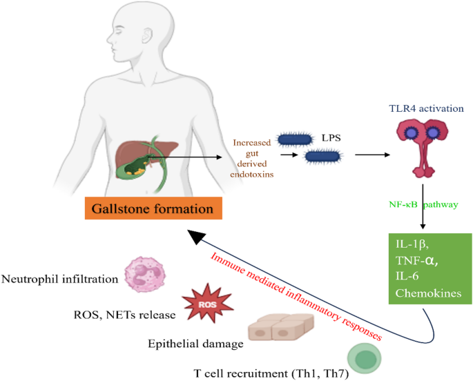 glutathione gallstones Immunometabolic crosstalk in gallstone disease: driving roles of bacterial infection, NETs and MMP activation | Molecular Biology Reports GHK-CU- Cosmetic for Healthy Skin Aging and Wrinkle Support