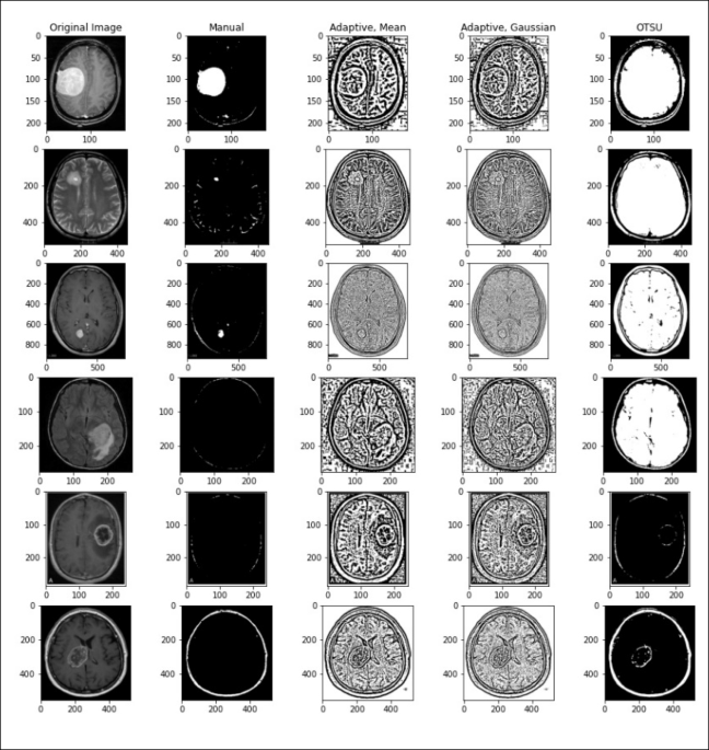 Symmetry-based brain abnormality identification in Magnetic