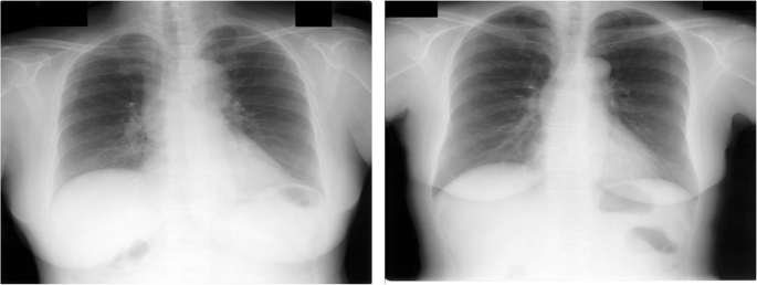 Reducible tissue and principal component fusion based x-ray image boosting for healthcare applications - Multimedia Tools and Applications