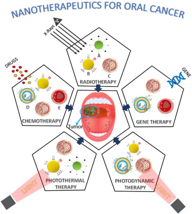 Recent advances in nanomedicine for innovative oral cancer therapeutics—a review | Journal of Nanoparticle Research