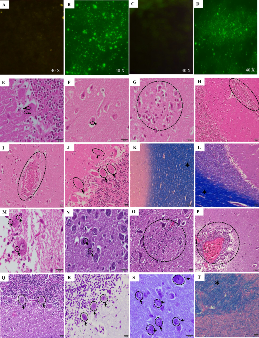 https://media.springernature.com/m685/springer-static/image/art%3A10.1007%2Fs11064-022-03556-6/MediaObjects/11064_2022_3556_Fig2_HTML.png