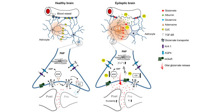 Schematic representation illustrating the astrocyte-synapse alterations