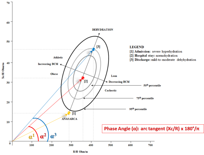 Comparison of Bioelectrical Impedance Vector Analysis (BIVA) to 7