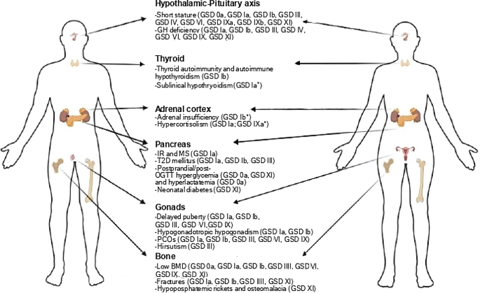 is l-carnitine prescribed for cushings Endocrine involvement in hepatic glycogen storage diseases: pathophysiology and implications care | Reviews in Endocrine and Metabolic Disorders L-Carnitine: Benefits, Uses, and Side