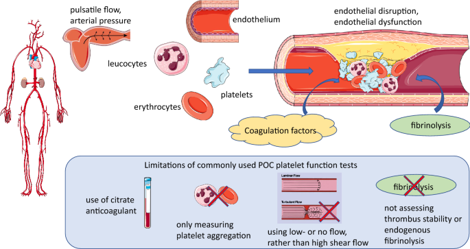 Point-of-care platelet function tests: relevance to arterial thrombosis and  opportunities for improvement | Journal of Thrombosis and Thrombolysis