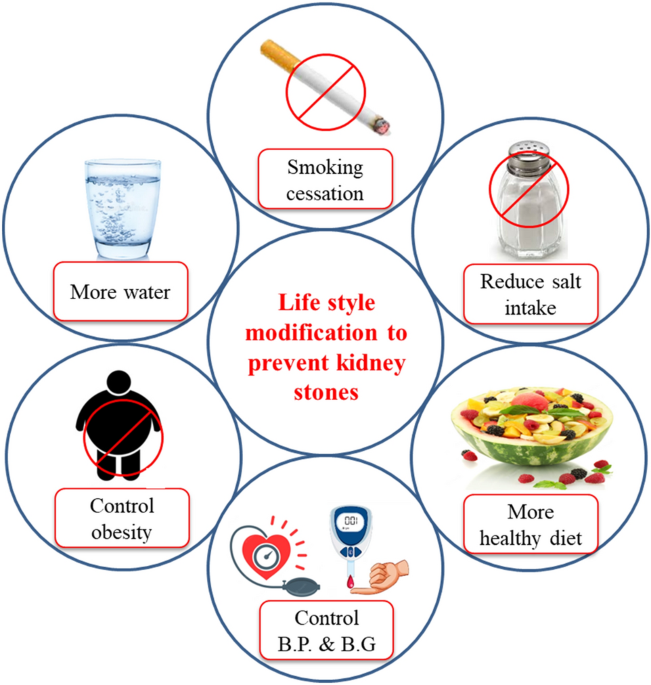 do cigarettes cause kidney stones Kidney stones: natural remedies and lifestyle modifications to alleviate  their burden | International Urology and Nephrology