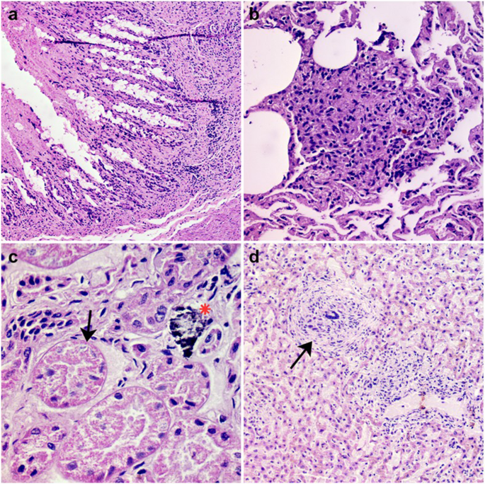 Disseminated paracoccidioidomycosis in a black lion tamarin (Leontopithecus chrysopygus) confirmed by histopathology, molecular diagnostics and phylogenetic analysis of DNA from FFPE tissues - Veterinary Research Communications