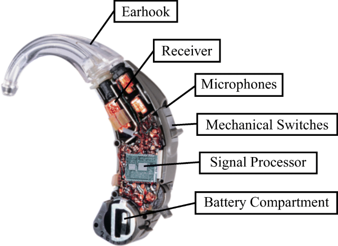 A Survey on Application Specific Processor Architectures for Digital  Hearing Aids | Journal of Signal Processing Systems