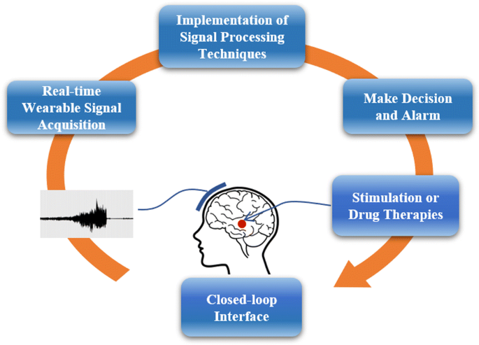 EEG detection systems. 1-1: major components of the seizure advisory