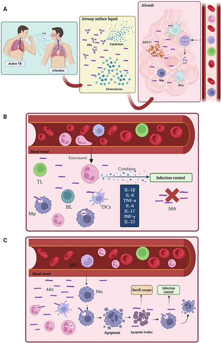 Clinical manifestations and immune response to tuberculosis