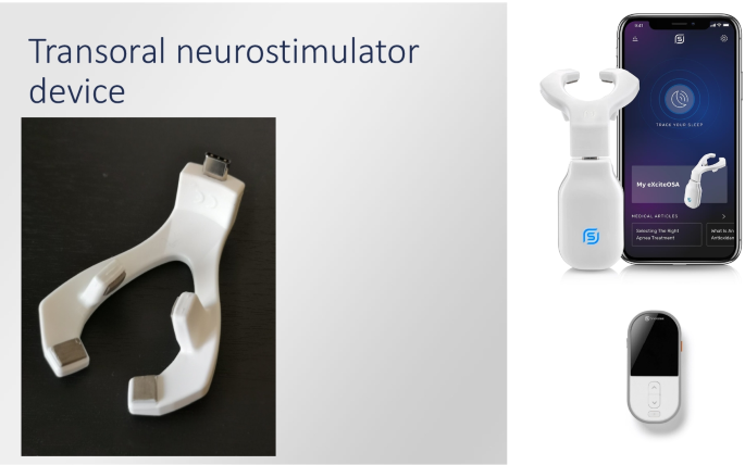 Daytime OSA Therapy: Intraoral Neuromuscular Electrical Stimulation and its  Mechanism of Action 