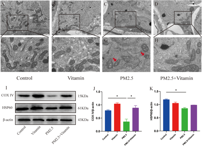 Mitochondrial defects caused by PARL deficiency lead to arrested  spermatogenesis and ferroptosis