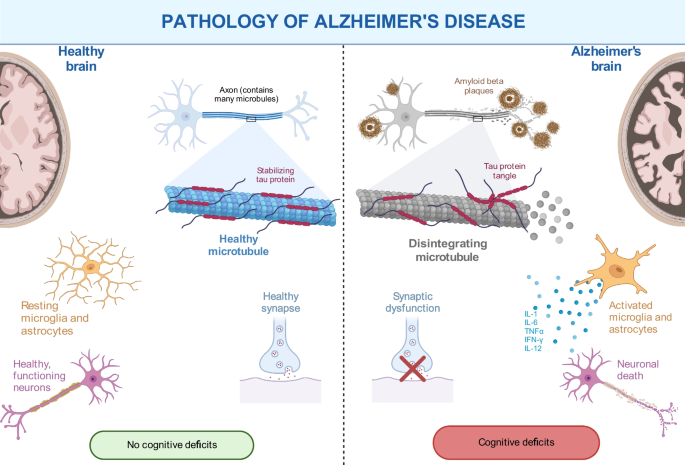 Alzheimer's: Menthol boosts cognitive function in mouse models
