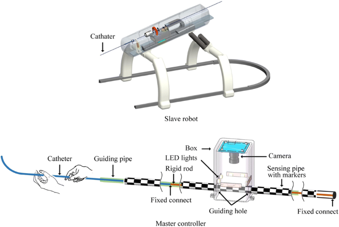 A novel noncontact detection method of surgeon's operation for a master- slave endovascular surgery robot | Medical & Biological Engineering &  Computing
