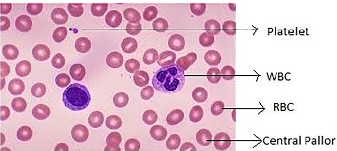 Analysis of red blood cells from peripheral blood smear images for anemia  detection: a methodological review | Medical & Biological Engineering &  Computing