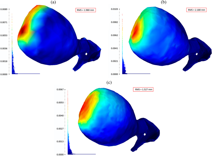 Multiphysics and multiscale modeling of uterine contractions: integrating  electrical dynamics and soft tissue deformation with fiber orientation |  SpringerLink