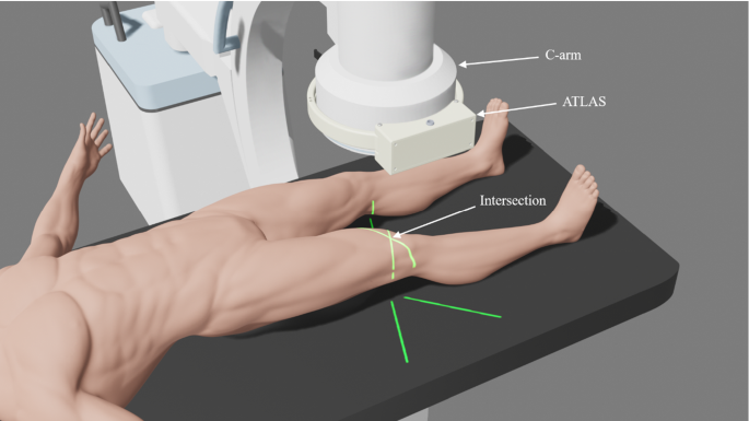 C arm laser aiming device