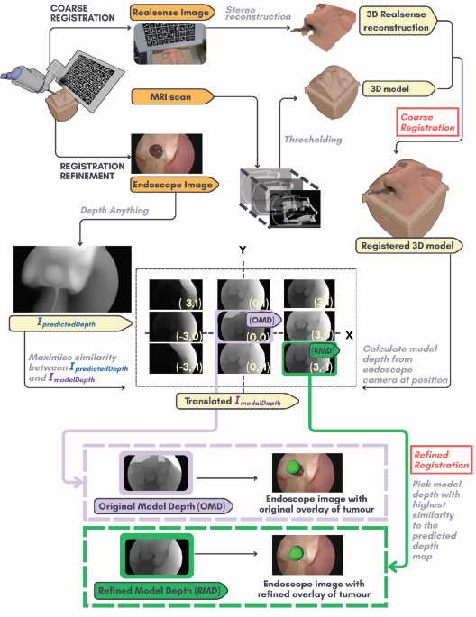 Depth-based local registration refinement for augmented reality in pituitary surgery - International Journal of Computer Assisted Radiology and Surgery