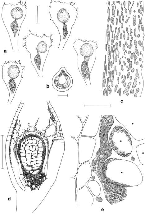 Octospora tucumanensis (Pezizales), a new bryophilous ascomycete on  Dimerodontium balansae (Bryophyta) from Argentina
