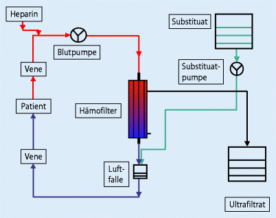 Ersatz-Pumpe & -Netzteil für Vital Flow