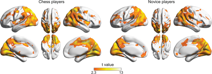 Pattern of focal γ-bursts in chess players