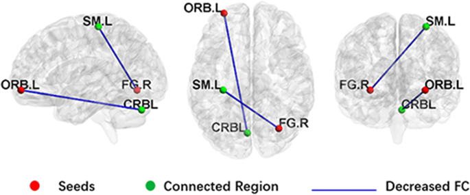 Inconsistency between cortical reorganization and functional