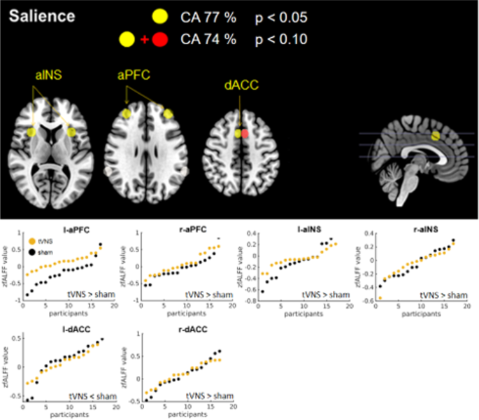 The vagus afferent network: emerging role in translational connectomics in:  Neurosurgical Focus Volume 45 Issue 3 (2018) Journals