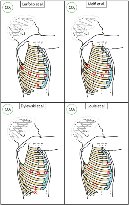 Basic Principles and Advanced VATS Procedures