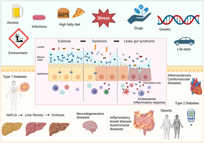 bpc-157 leaky gut or intestinal permeability Gut microbiota, intestinal permeability, and systemic inflammation: a  narrative review | Internal and Emergency Medicine
