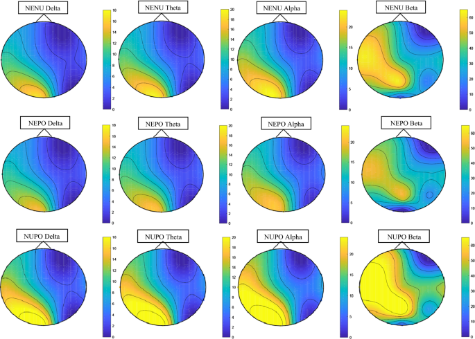 Electrical scalp map topographies (for each group, at the MMN